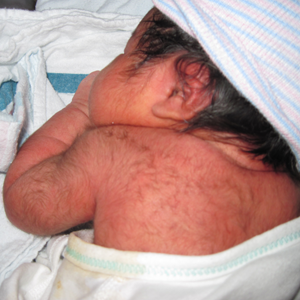 Human babies are born with a vestigial coat of hair called 'lanugo.' http://www.babyfaq.info/skin/lanugo.php