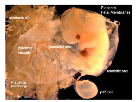 Human embryos have a yolk sac early in development. http://discoveringsomethingneweveryday.blogspot.com/2012/11/human-embryo-at-6-weeks-only-half-inch.htmlhttp://biologicalfreak0729.blogspot.com/2012_10_01_archive.html